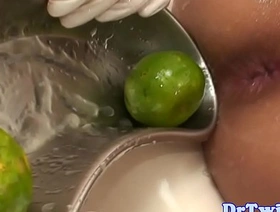 年轻的亚洲患者会对肛门柠檬恋物癖感到惊讶 hot gay twins porn