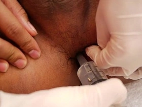 泰国twinks被角质医生检查 gay japan doctor porn